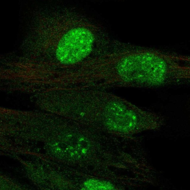 TERT Antibody in Immunocytochemistry (ICC/IF)