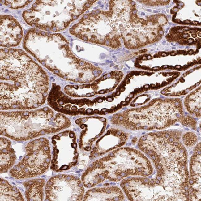 MT-CO2 Antibody in Immunohistochemistry (Paraffin) (IHC (P))