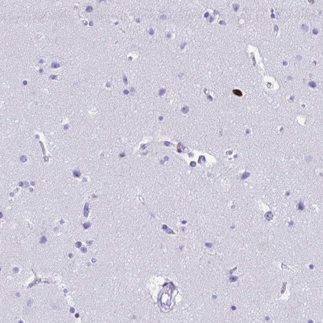 CD43 Antibody in Immunohistochemistry (Paraffin) (IHC (P))