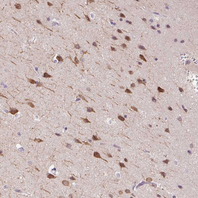 DTX1 Antibody in Immunohistochemistry (Paraffin) (IHC (P))