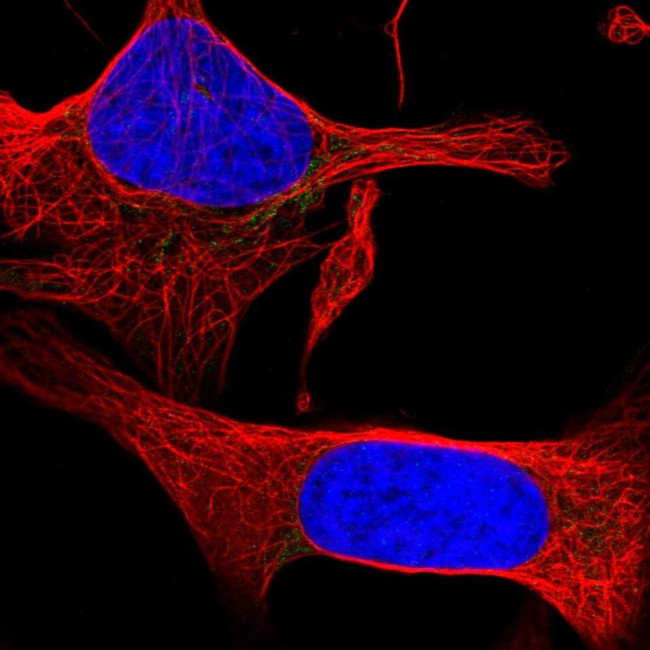 PPAP2C Antibody in Immunocytochemistry (ICC/IF)