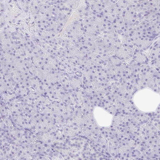 TLX Antibody in Immunohistochemistry (Paraffin) (IHC (P))