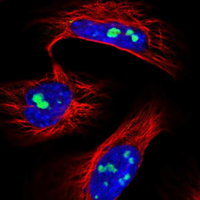 UTP6 Antibody in Immunocytochemistry (ICC/IF)