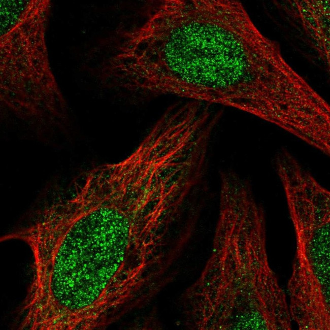 BCOR Antibody in Immunocytochemistry (ICC/IF)