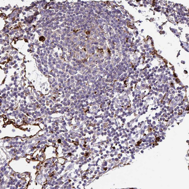 FUCA1 Antibody in Immunohistochemistry (Paraffin) (IHC (P))