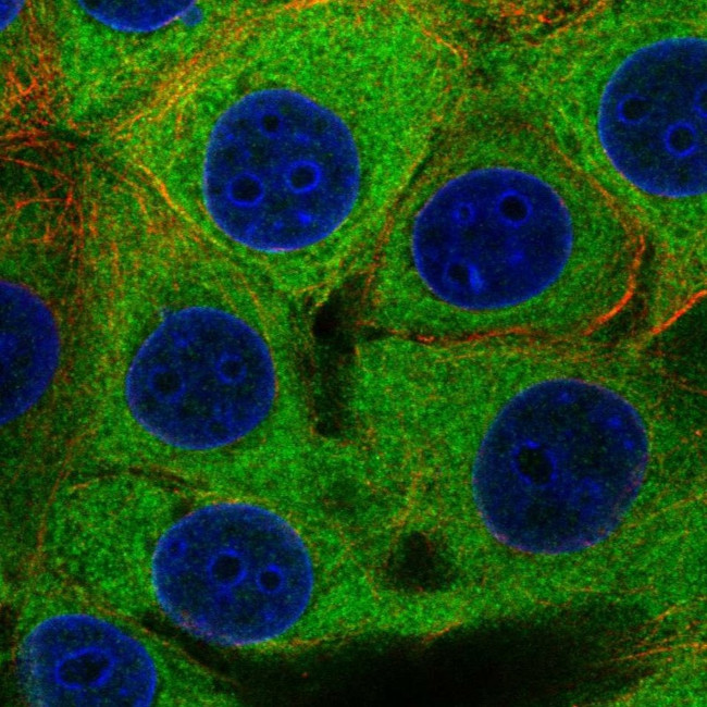 PFKP Antibody in Immunocytochemistry (ICC/IF)