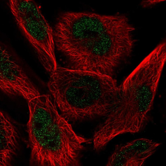 AP2 alpha Antibody in Immunocytochemistry (ICC/IF)