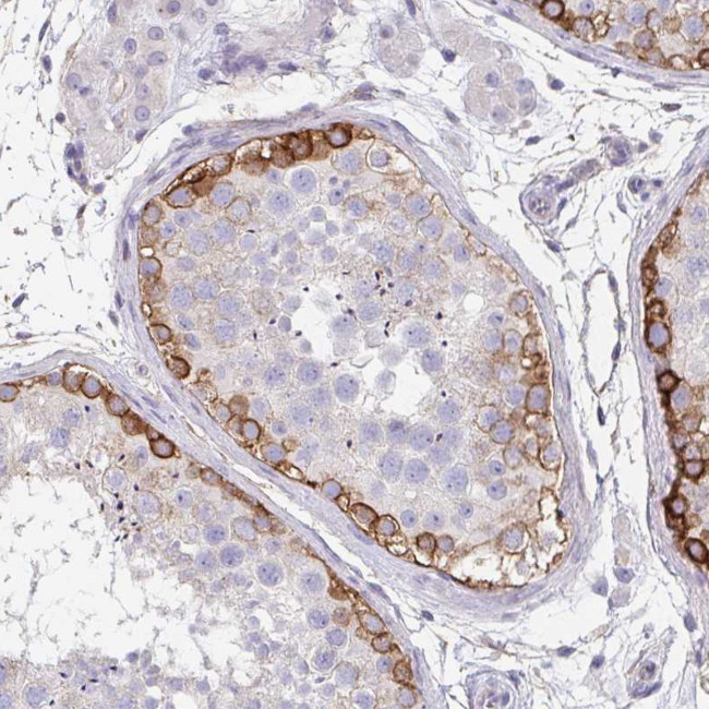 Drebrin Antibody in Immunohistochemistry (Paraffin) (IHC (P))