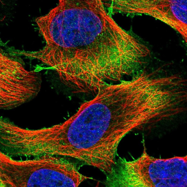 UBE2S Antibody in Immunocytochemistry (ICC/IF)