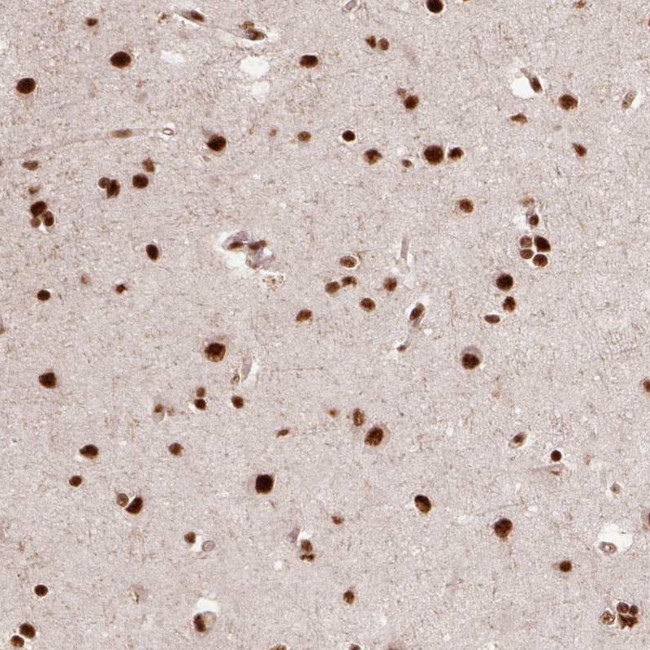 PPIG Antibody in Immunohistochemistry (Paraffin) (IHC (P))