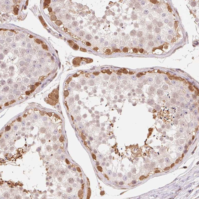 CDC123 Antibody in Immunohistochemistry (Paraffin) (IHC (P))