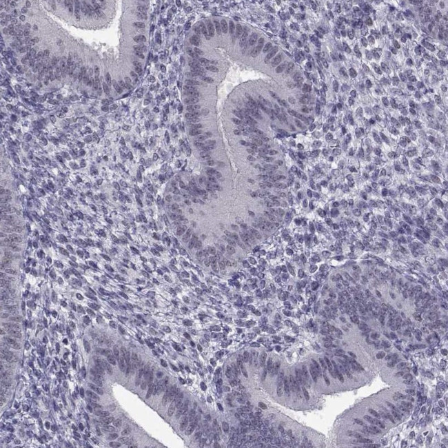 MED26 Antibody in Immunohistochemistry (Paraffin) (IHC (P))