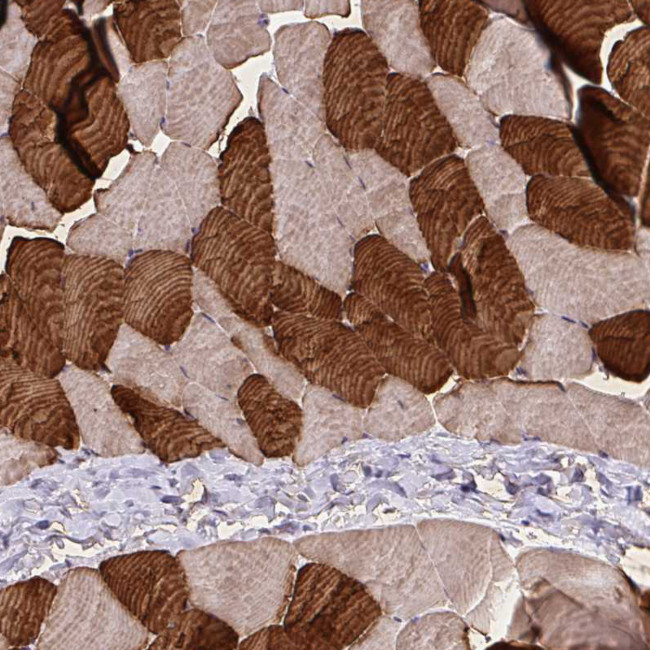 TNNT1 Antibody in Immunohistochemistry (Paraffin) (IHC (P))