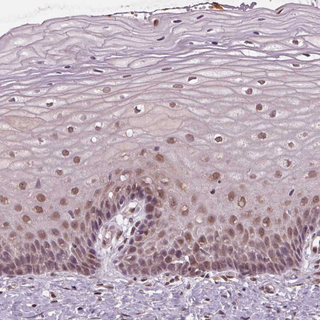 STAT3 Antibody in Immunohistochemistry (Paraffin) (IHC (P))