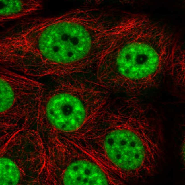 PRP19 Antibody in Immunocytochemistry (ICC/IF)