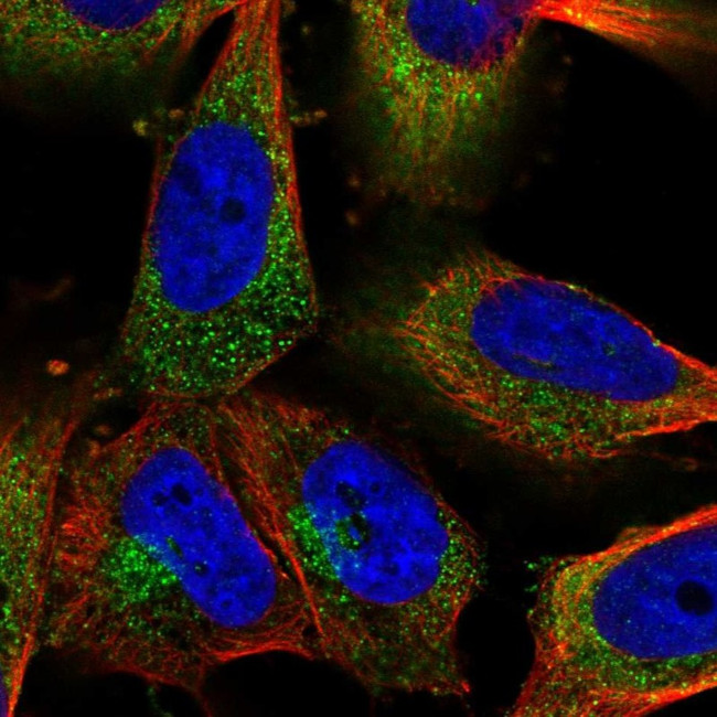 Clathrin Heavy Chain Antibody in Immunocytochemistry (ICC/IF)