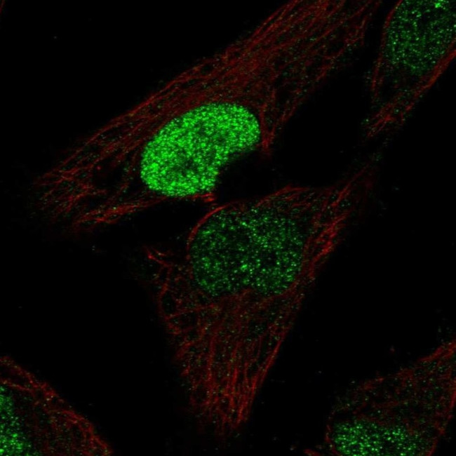 PDX1 Antibody in Immunocytochemistry (ICC/IF)