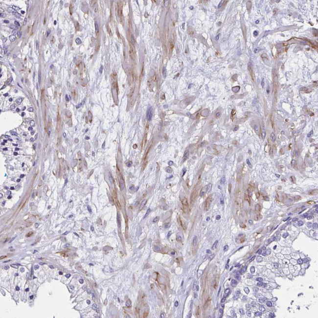 ITGB1 Antibody in Immunohistochemistry (Paraffin) (IHC (P))