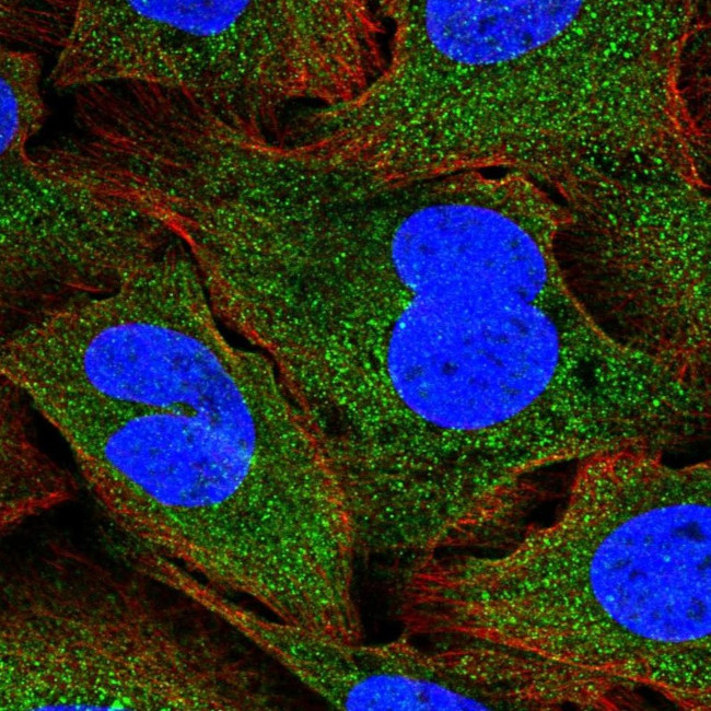 EAP30 Antibody in Immunocytochemistry (ICC/IF)