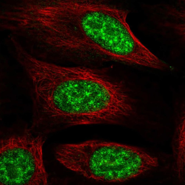 NMNAT1 Antibody in Immunocytochemistry (ICC/IF)