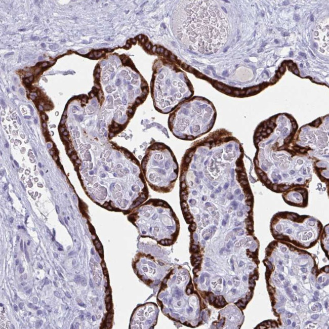 PRDM9 Antibody in Immunohistochemistry (Paraffin) (IHC (P))