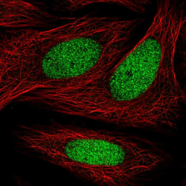 ZNF182 Antibody in Immunocytochemistry (ICC/IF)