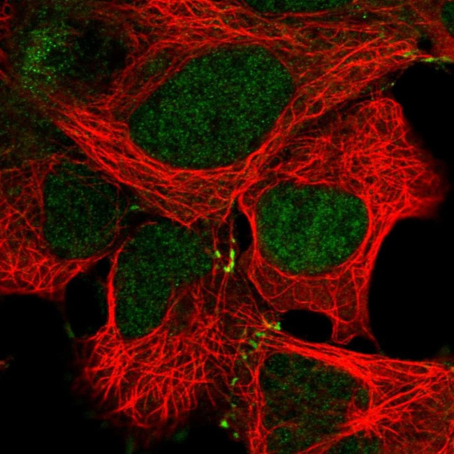 MAP2K4 Antibody in Immunocytochemistry (ICC/IF)