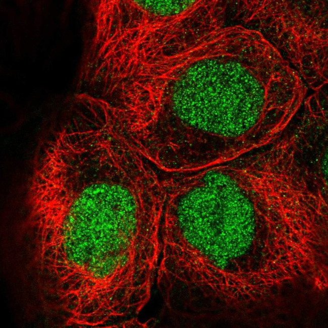 EED Antibody in Immunocytochemistry (ICC/IF)