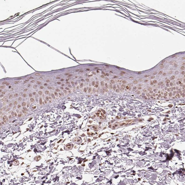 ACOT2 Antibody in Immunohistochemistry (Paraffin) (IHC (P))