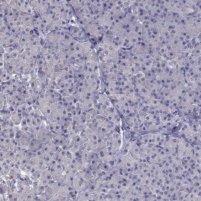 FAM101B Antibody in Immunohistochemistry (Paraffin) (IHC (P))