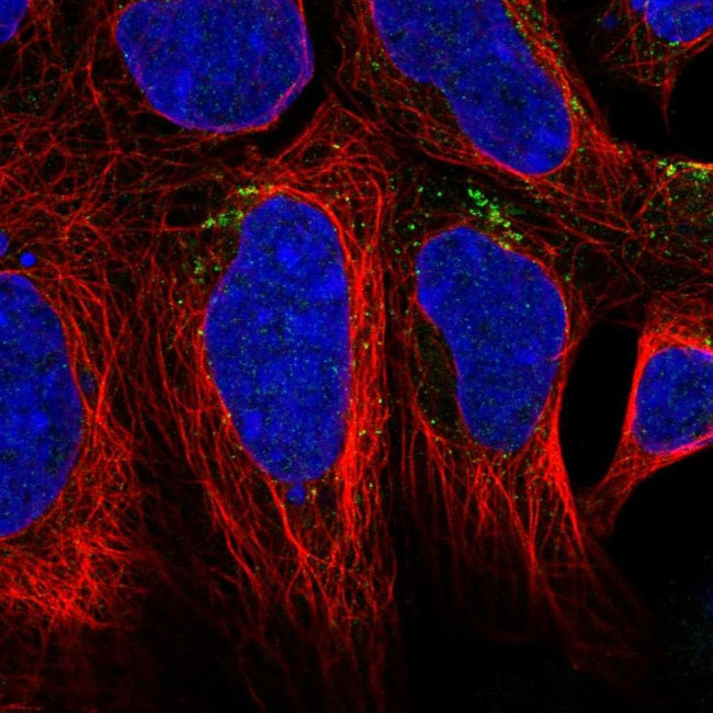 AGPAT4 Antibody in Immunocytochemistry (ICC/IF)