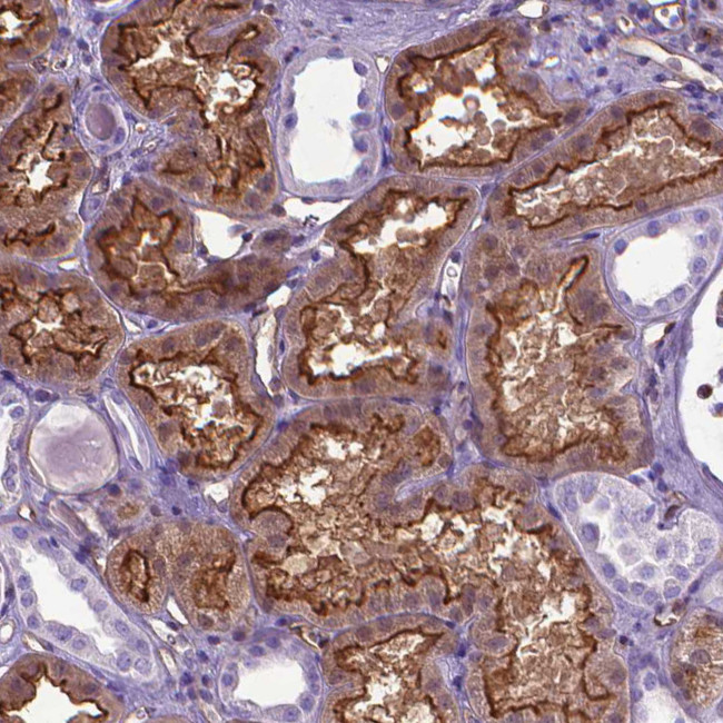 CLIC4 Antibody in Immunohistochemistry (Paraffin) (IHC (P))