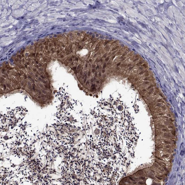 LCN9 Antibody in Immunohistochemistry (Paraffin) (IHC (P))