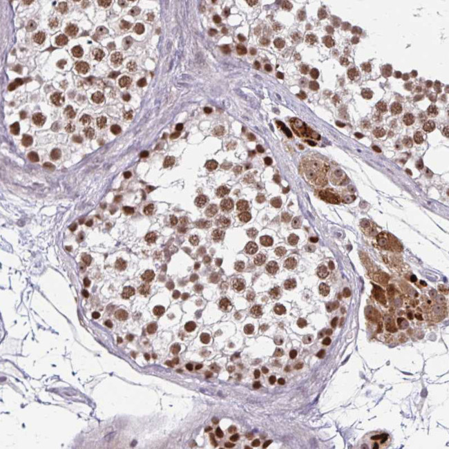 EED Antibody in Immunohistochemistry (Paraffin) (IHC (P))