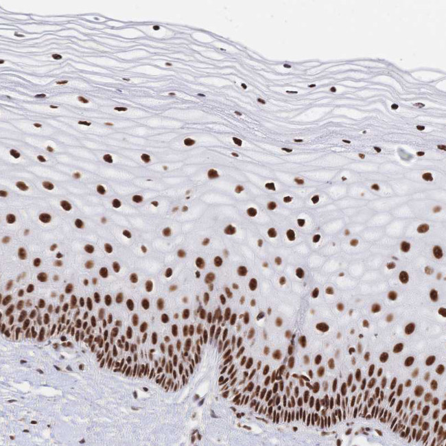 SRSF1 Antibody in Immunohistochemistry (Paraffin) (IHC (P))