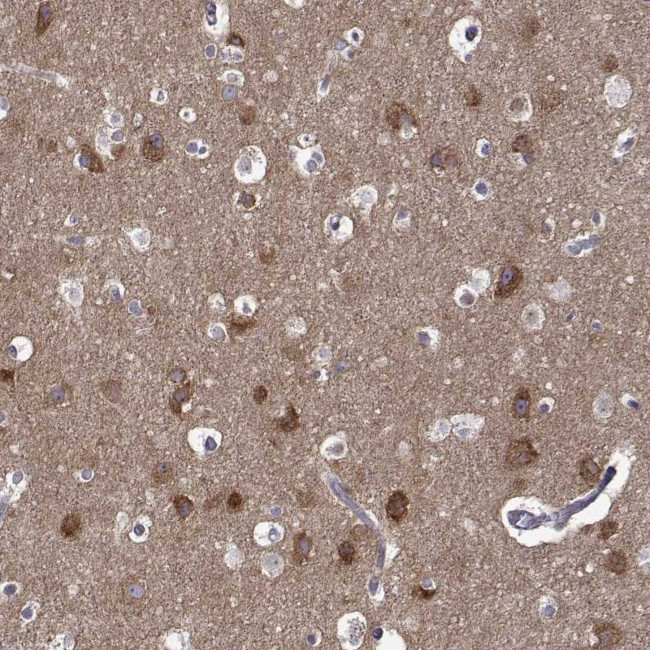 TRBP Antibody in Immunohistochemistry (Paraffin) (IHC (P))