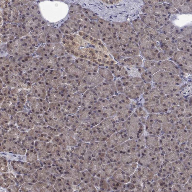 ALS2CR1 Antibody in Immunohistochemistry (Paraffin) (IHC (P))