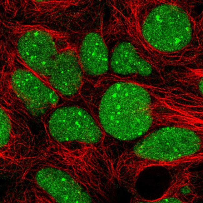 GTF2B Antibody in Immunocytochemistry (ICC/IF)