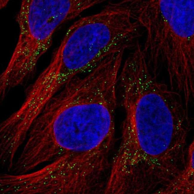 RyR3 Antibody in Immunocytochemistry (ICC/IF)