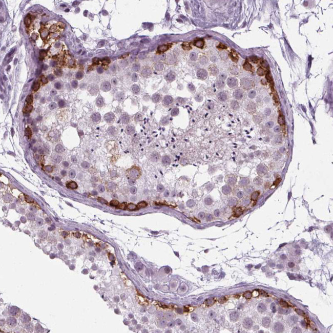 IGF2BP1 Antibody in Immunohistochemistry (Paraffin) (IHC (P))