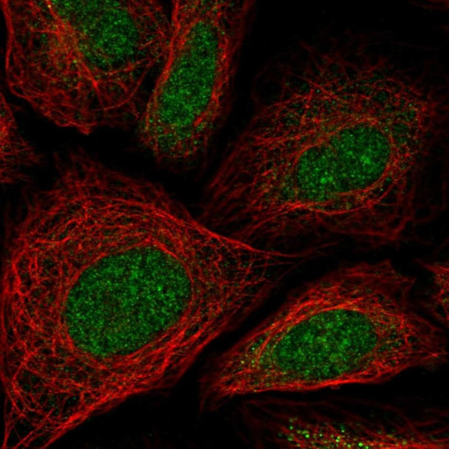 ZNF181 Antibody in Immunocytochemistry (ICC/IF)