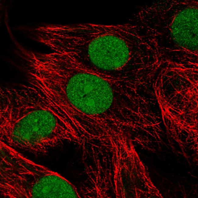 HMGB3 Antibody in Immunocytochemistry (ICC/IF)