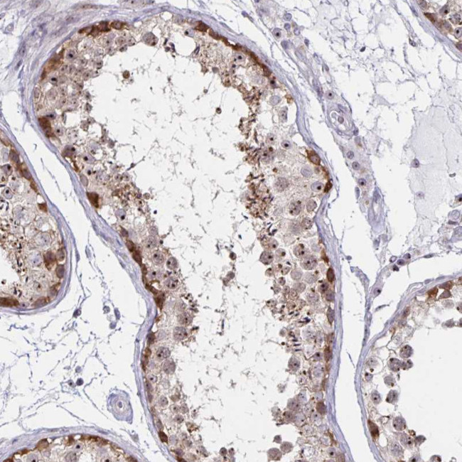 NUP85 Antibody in Immunohistochemistry (Paraffin) (IHC (P))