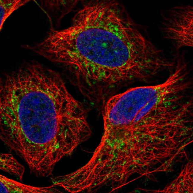 DLAT Antibody in Immunocytochemistry (ICC/IF)