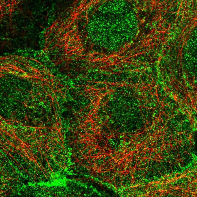 PKP3 Antibody in Immunocytochemistry (ICC/IF)