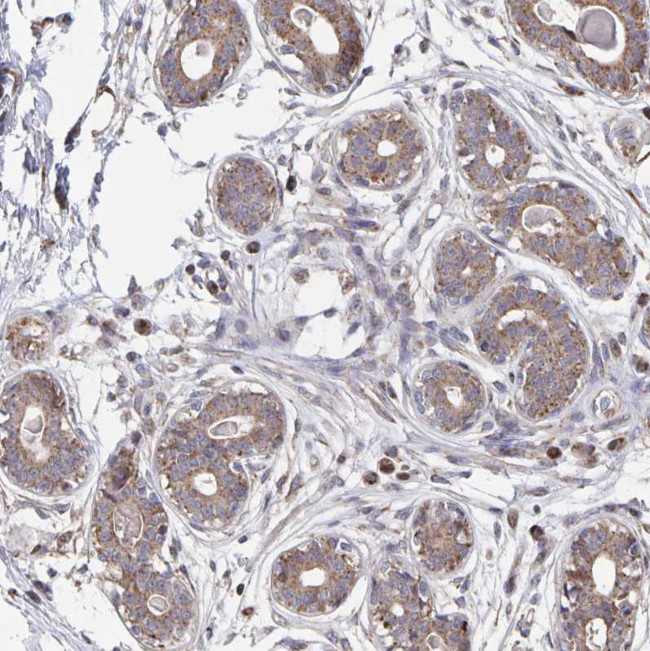 Acetyl-CoA Carboxylase Antibody in Immunohistochemistry (Paraffin) (IHC (P))