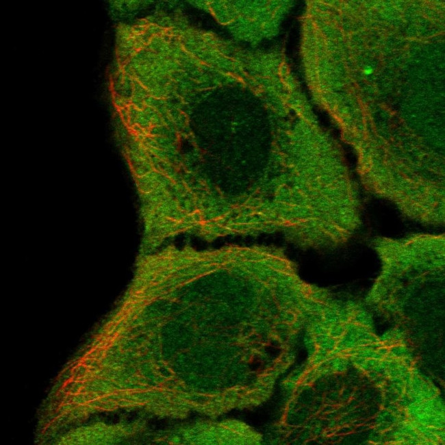 IRF6 Antibody in Immunocytochemistry (ICC/IF)