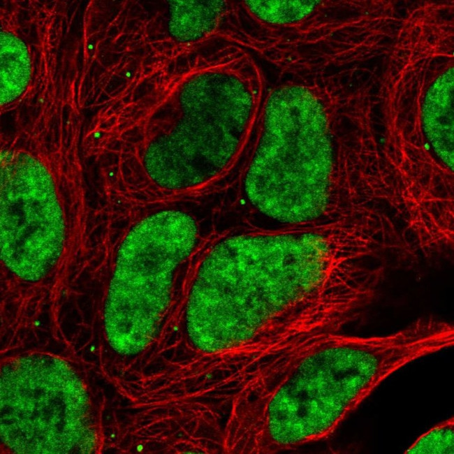 DDX17 Antibody in Immunocytochemistry (ICC/IF)