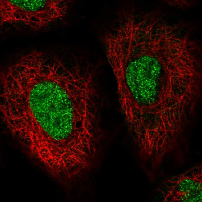 HSP40 Antibody in Immunocytochemistry (ICC/IF)