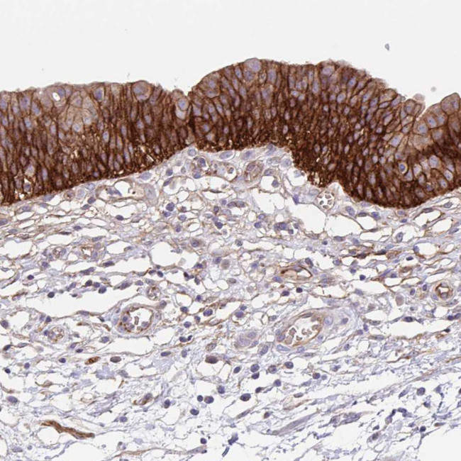 ITGA2 Antibody in Immunohistochemistry (Paraffin) (IHC (P))